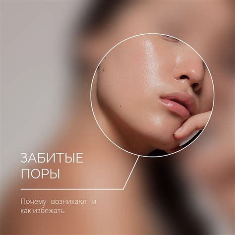 Забитые поры! Что делать? Пытались ли вы когда-нибудь самостоятельно ...