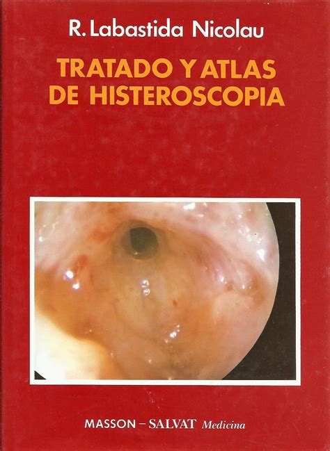 Tratado y Atlas de Histeroscopia | Blog de Tomás Cabacas