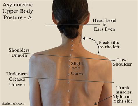 What Causes Pain In The Neck