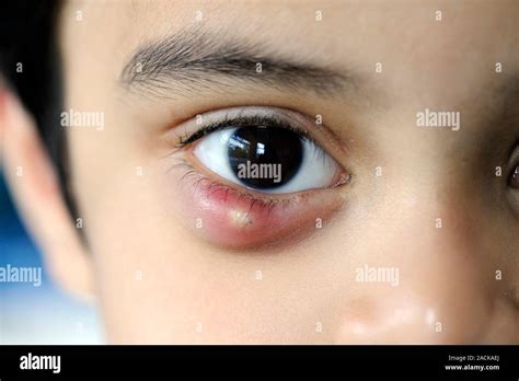 television     television close