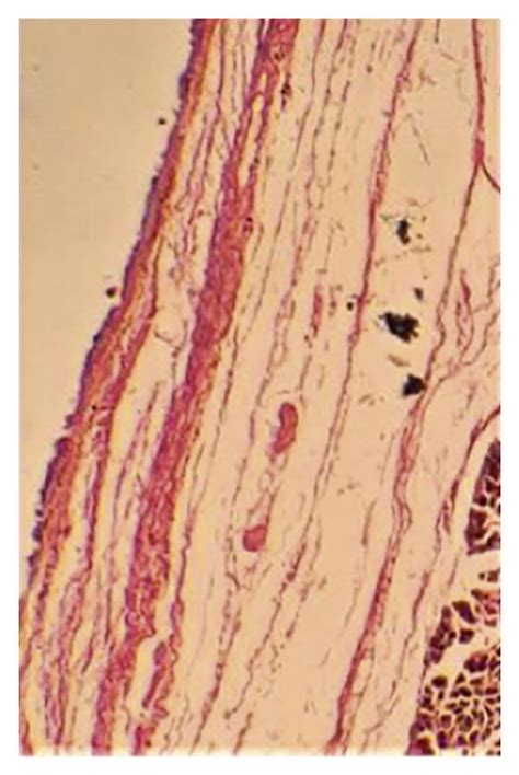 Coronal section of excised lingual frenulum under tension (specimen 2 ...