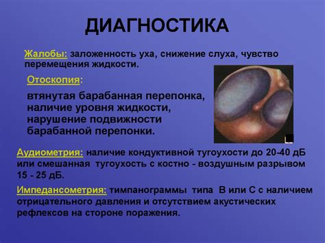 Острый средний отит. Мастоидит - презентация онлайн