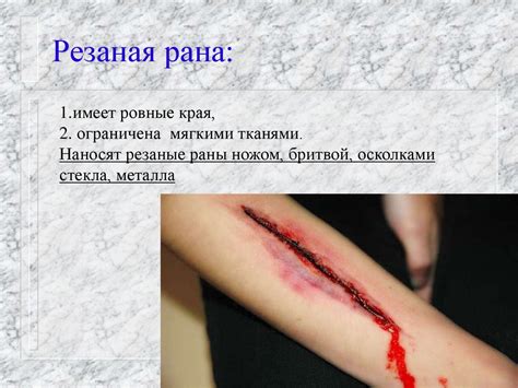 Раны и раневой процесс - презентация онлайн