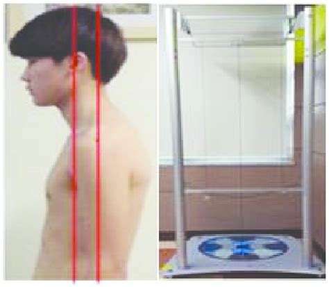 Forward head posture measurement | Download Scientific Diagram