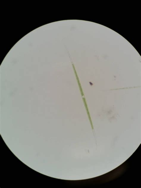 BIOL213 | PLANTS TWO: MYSTERY POND WATER ORGANISMS BY GROUP REJ