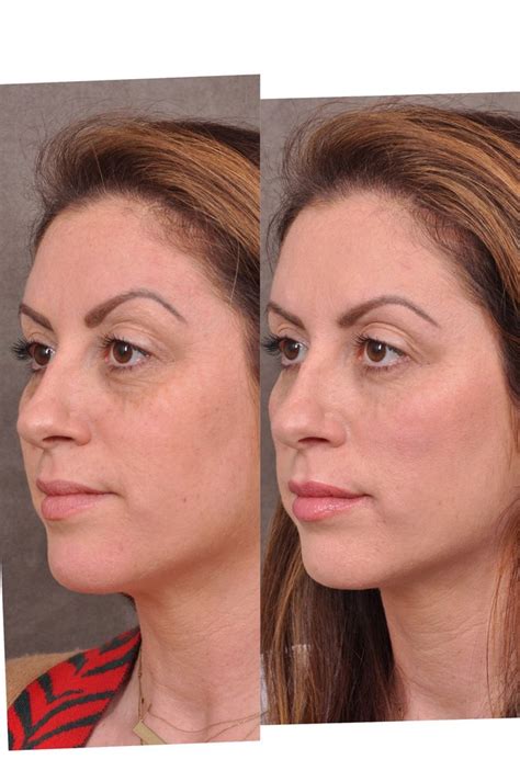 ben talei md    reviews   roxbury dr beverly