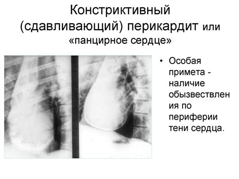 Лучевая диагностика заболеваний сердца и сосудов - online presentation