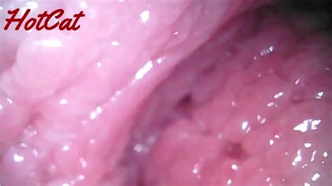 osservazione vaginale endoscopica video porno gratis youporn italiano