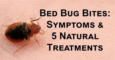 Identify Bed Bug Bites Pets