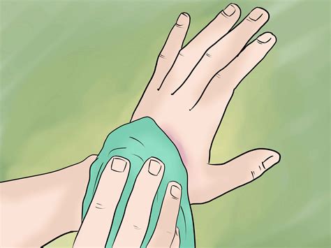Перелом кисти руки: лечение, симптомы, реабилитация
