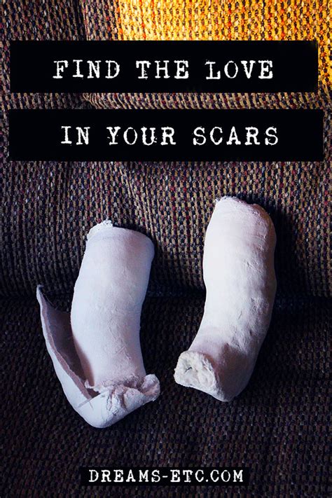 Find the Love in Your Scars // The Love That Makes All the Difference