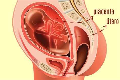 Descolamento de placenta é problema sério? Tem que ficar internada ...
