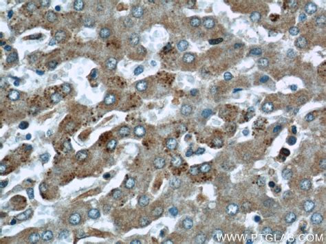 ABHD5 antibody (12201-1-AP) | Proteintech