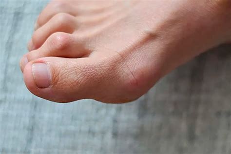 relieve pain    foot  podiatry helps