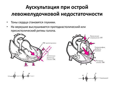 Недостаточность кровообращения. Классификация недостаточности ...
