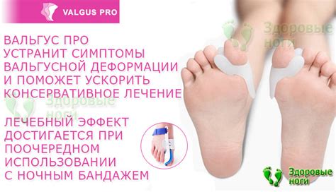 Купить Valgus Pro (Вальгус Про) - ортопедический фиксатор большого ...