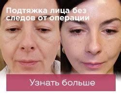 Подтяжка лица