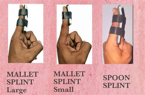 mallet splint spoon splint  rs piece finger splint  surat id