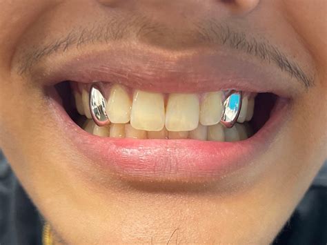 2x Sterling Silver 925 Grillz Any Teeth UK Worldwide Shipping - Etsy