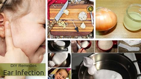 How to Get Rid of Ear Infection Naturally
