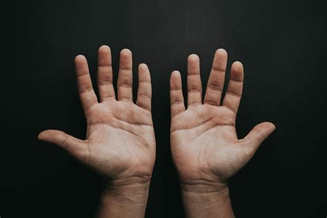 What is Excoriation? - SOVA