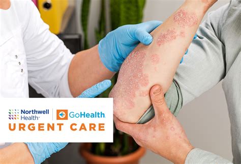 how to know if a scrape is infected