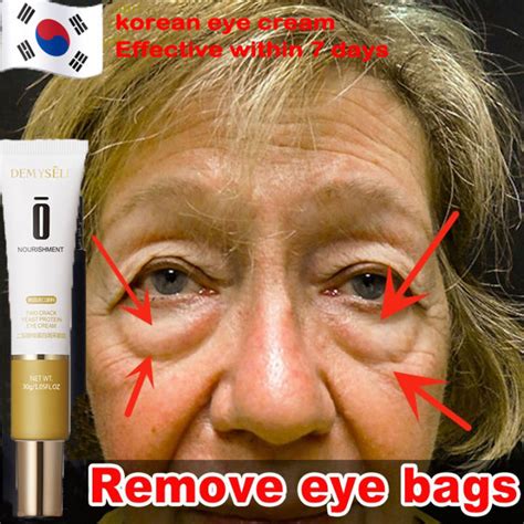 eyebags remover original eye cream dark circle under eye remover ...
