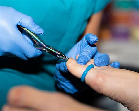 Nail Reconstruction at Perfect Skin Solutions