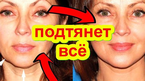 НАВИСШЕЕ ВЕКО ЛИЦО БРЫЛИ ! Естественный Лифтинг Без Пластики Маски для ...