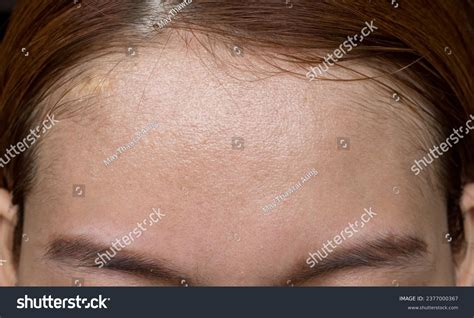 oily skin wide forehead southeast asian stock photo