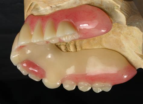 Biodentaplast - Zahntechnische Meisterwerkstatt Kipping & Zeitler