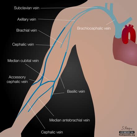 Basilic vein | Radiology Reference Article | Radiopaedia.org