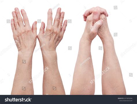365 Withered Arm Images, Stock Photos & Vectors | Shutterstock