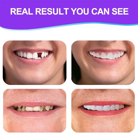 Nature Comfort Fake Teeth Set: Upper & Lower Dentures for Confident ...