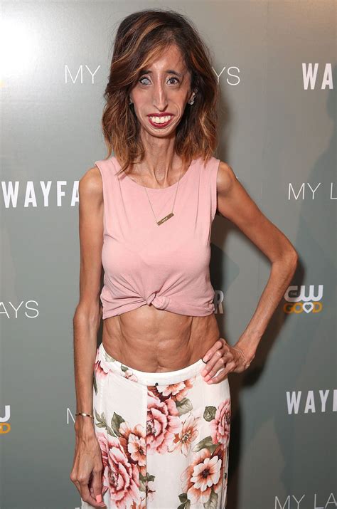 Pictures of Lizzie Velasquez