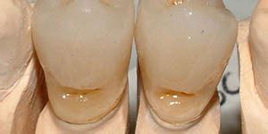 galvanic electrodeposition laboratorio maurizio melano metodo slaviceck