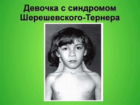 Хромосомные болезни - презентация онлайн