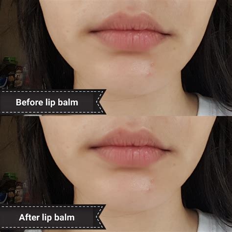Crusty Lips