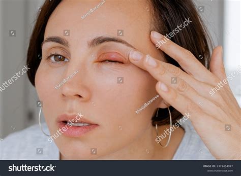 how to know if your eye is infected