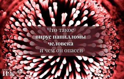 Вирус папилломы человека у женщин и мужчин. Симптомы. Лечение