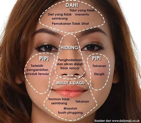 Letak Jerawat Menentukan Kesehatanmu - 𝕄𝔸ℤℕ𝔸ℝ𝔸