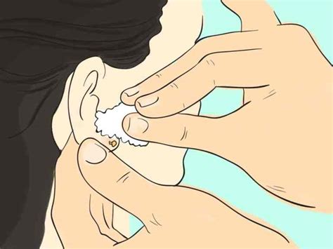 Minha Orelha Inflamou Devo Tirar O Brinco - Orelha Inflamada: Como Tratar Alergia A Brincos?