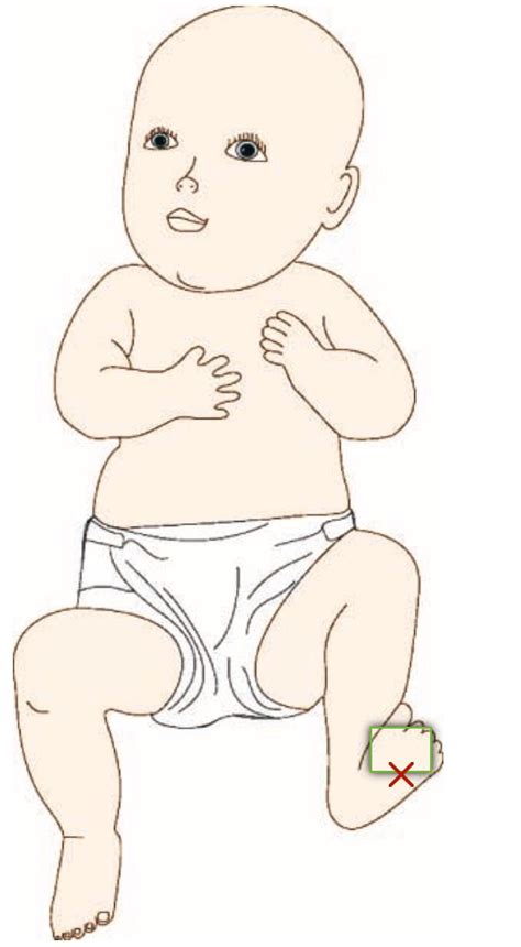 Select the location to perform a Babinski Reflex... So close. : r ...