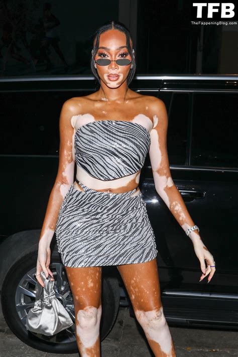 Winnie Harlow Nude Photos & Videos 2025 | #TheFappening