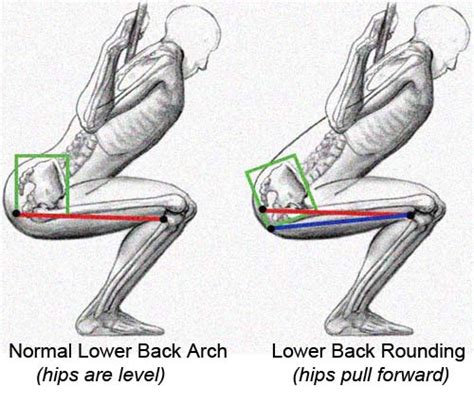Butt Wink Is Not About the Hamstrings - DeanSomerset.com