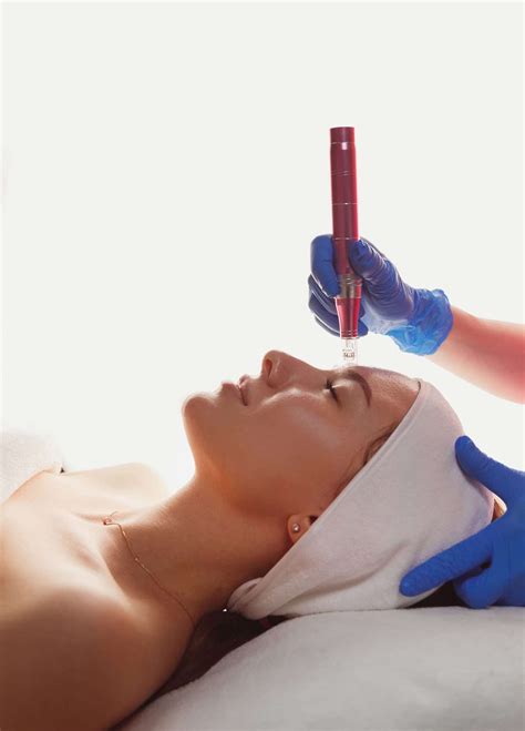 Microneedling with PRP - Clinique Médico Esthétique MK