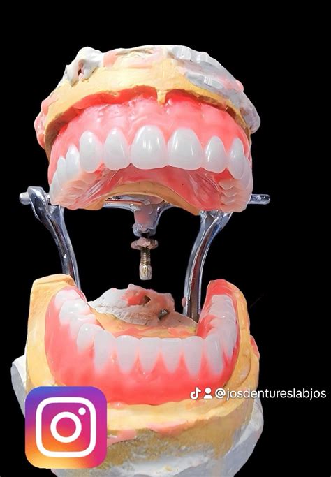The Ultimate Guide to DIY Dentures: Crafting Your Smile at Home” – My