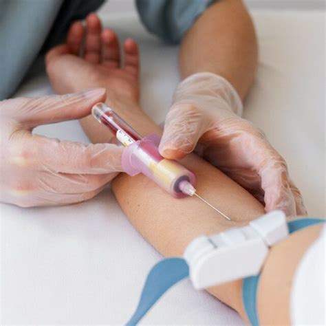 Como É Feito O Exame De Sangue - O Que Mostra um Exame de Sangue Completo - MundoBoaForma