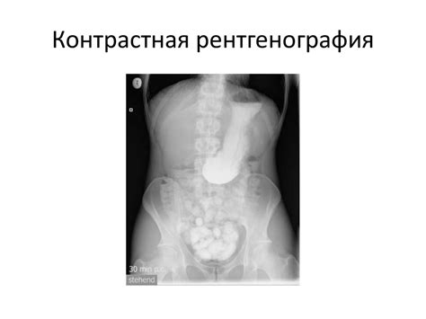 Заболевания и повреждения органов брюшной полости. Клинические симптомы ...