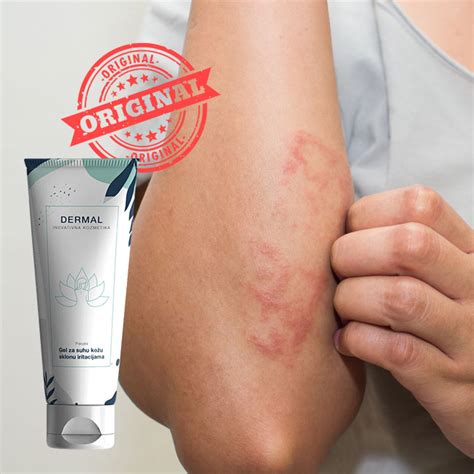 dermal bih tvoja priroda